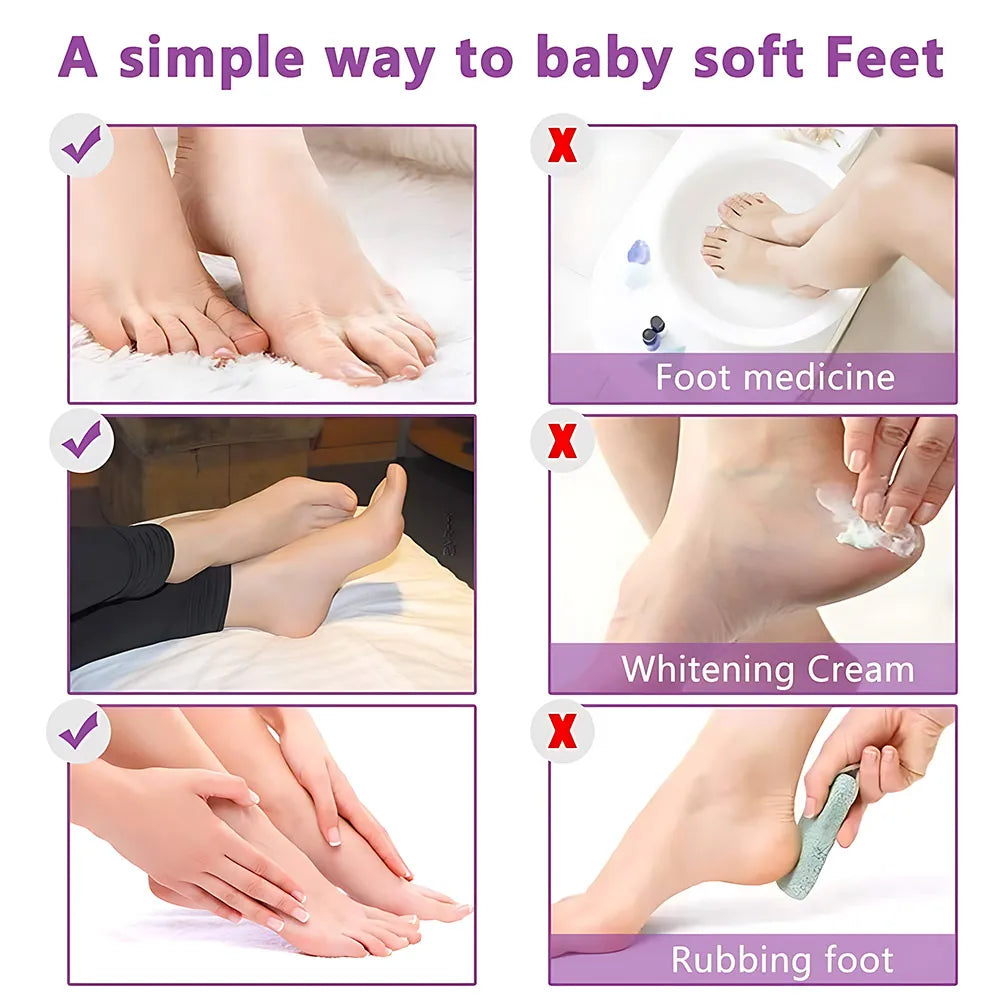 PC 15PCS Foot Peel Mask Baby Soft Feet Calluses Dead Dry Skin Cracked Heel