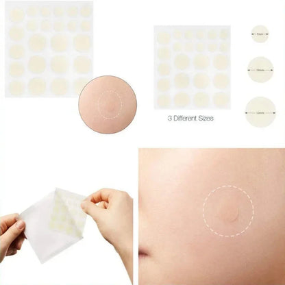 24pcs Face Acne Pimple Spot Facial Skin Care Blackhead Removal Freckle Patches Scar Care Treatment Stickers Acne Mask Beauty