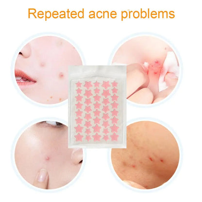 35/40pcs Acne Removal Pimple Patch Star-Shaped Invisible Hydrocolloid Pimple Patch Blemish Spot Cover Treatment Skin Care Tool