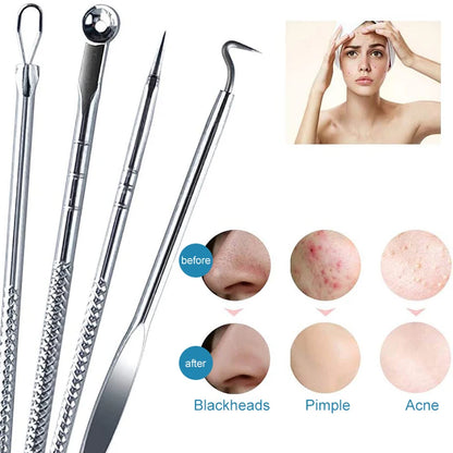 4Pcs/Set Acne Blackhead Removal Needles Stainless Pimple Spot Comedone Extractor Cleanser Beauty Face Cleaning Care Tools