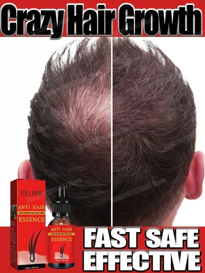 98% of buyers buy again, have more and more hair, say goodbye to baldness, thick hair,Hot selling product