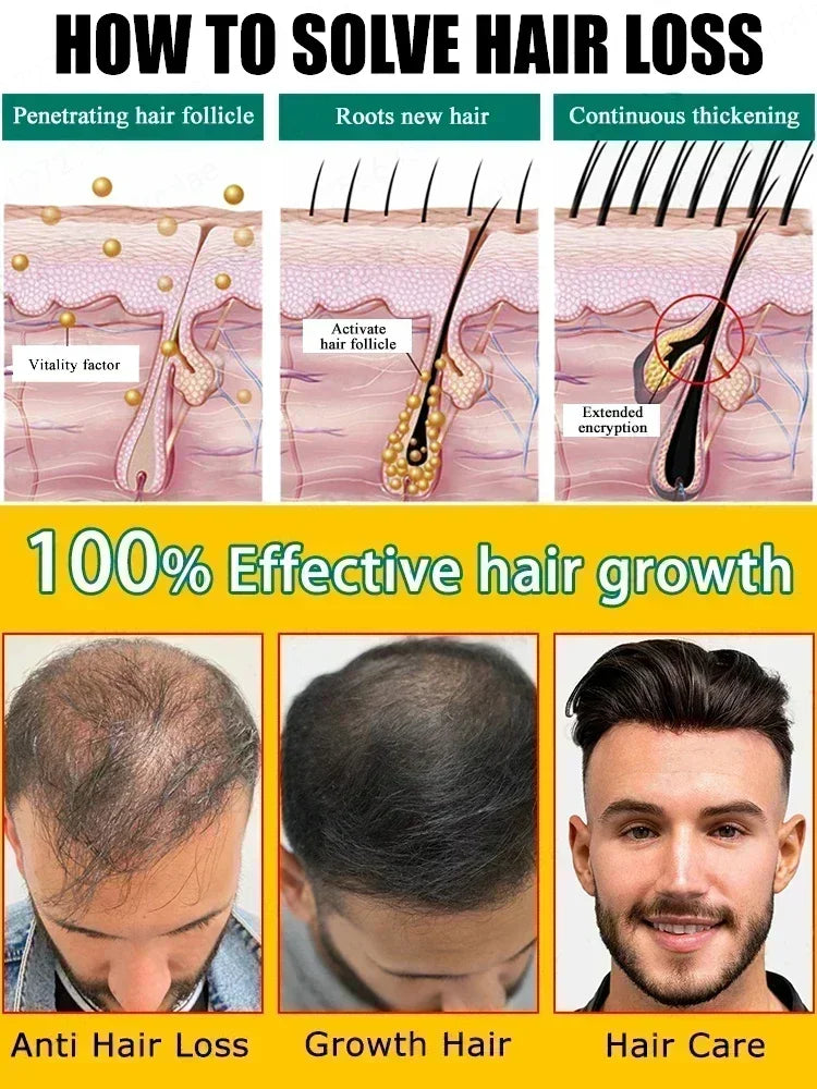 98% of buyers buy again, have more and more hair, say goodbye to baldness, thick hair,Hot selling product