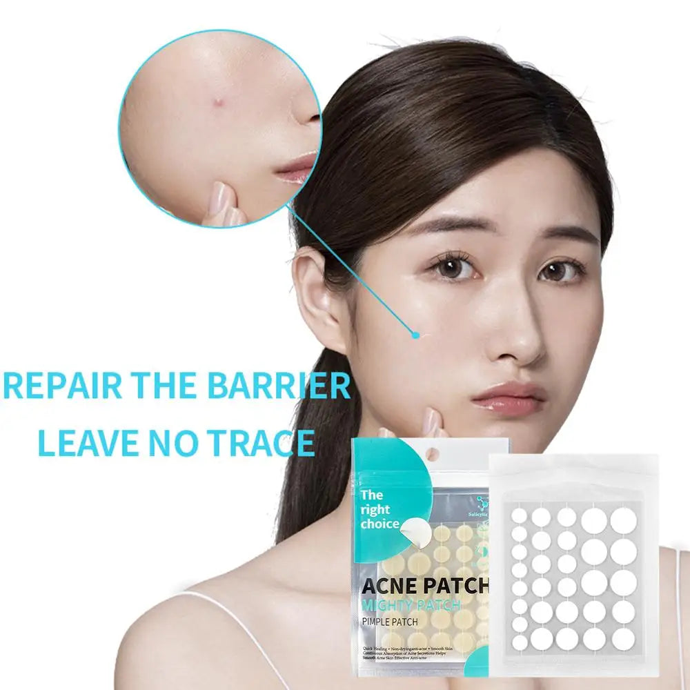 Acne Pimple Patch Stickers Waterproof Acne Treatment Tool Pimple Skin 30 Mask Blemish Spot Facial Care Remover Patches/bag