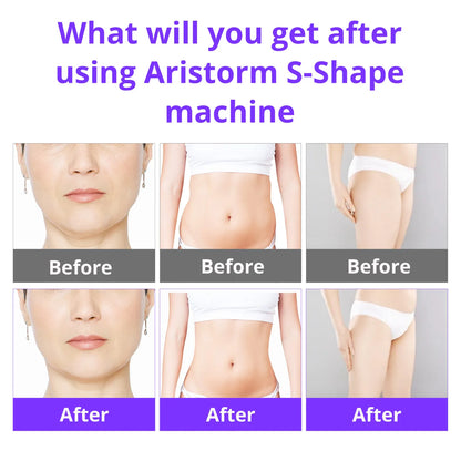 PC Aristorm S Shape Machine 30K Ultrasound Body Shape Facial Lifting home a