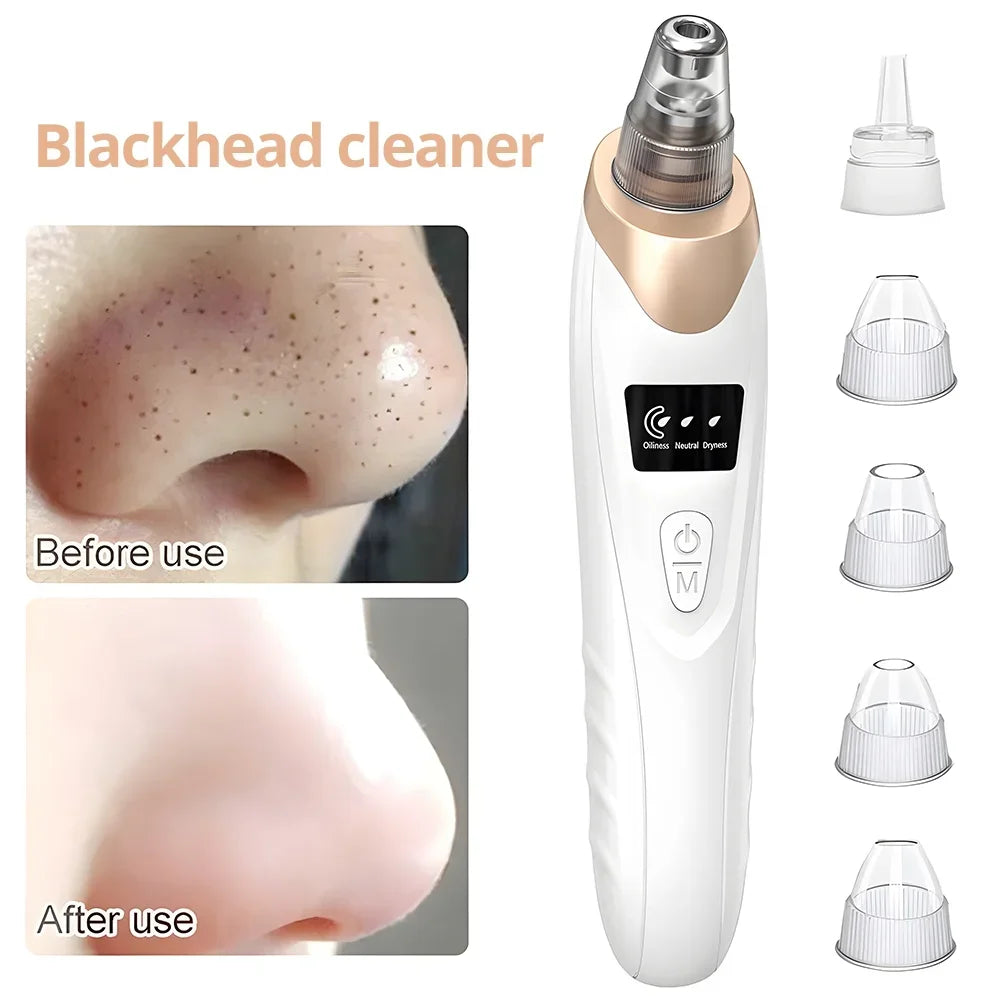 PC Blackhead Remover Pore Vacuum Face Cleaner Electric Pimple Acne Black He