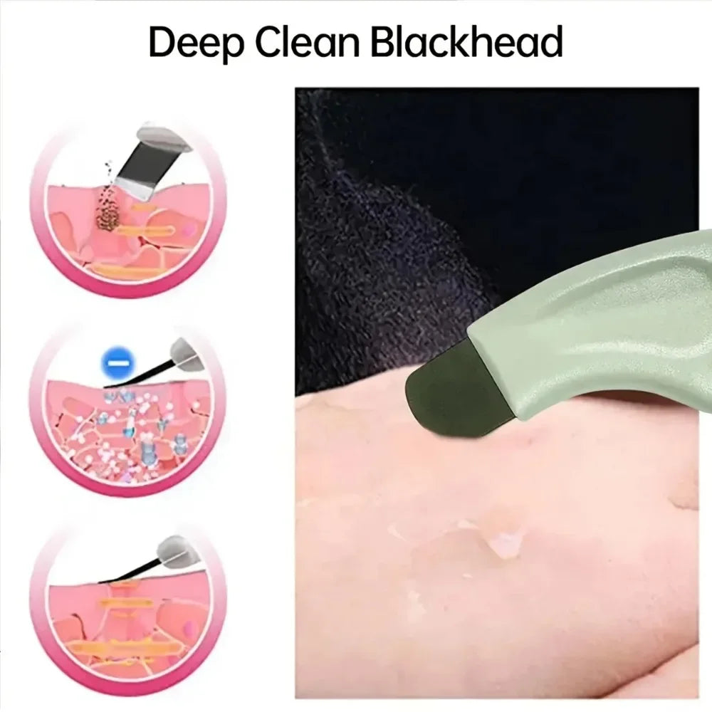 Deep Cleansing Master Blackhead Removal Tool Compatible with Mud Cream and Cleansing Oil  Pore Cleansing Facial Beauty Tool