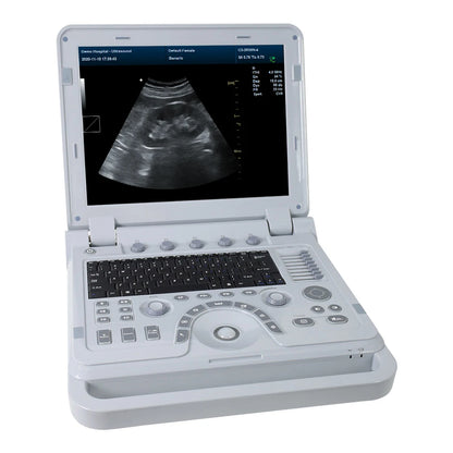 PCCONTEC CMS1700A-VET laptop 3D color ultrasound system and color doppler u