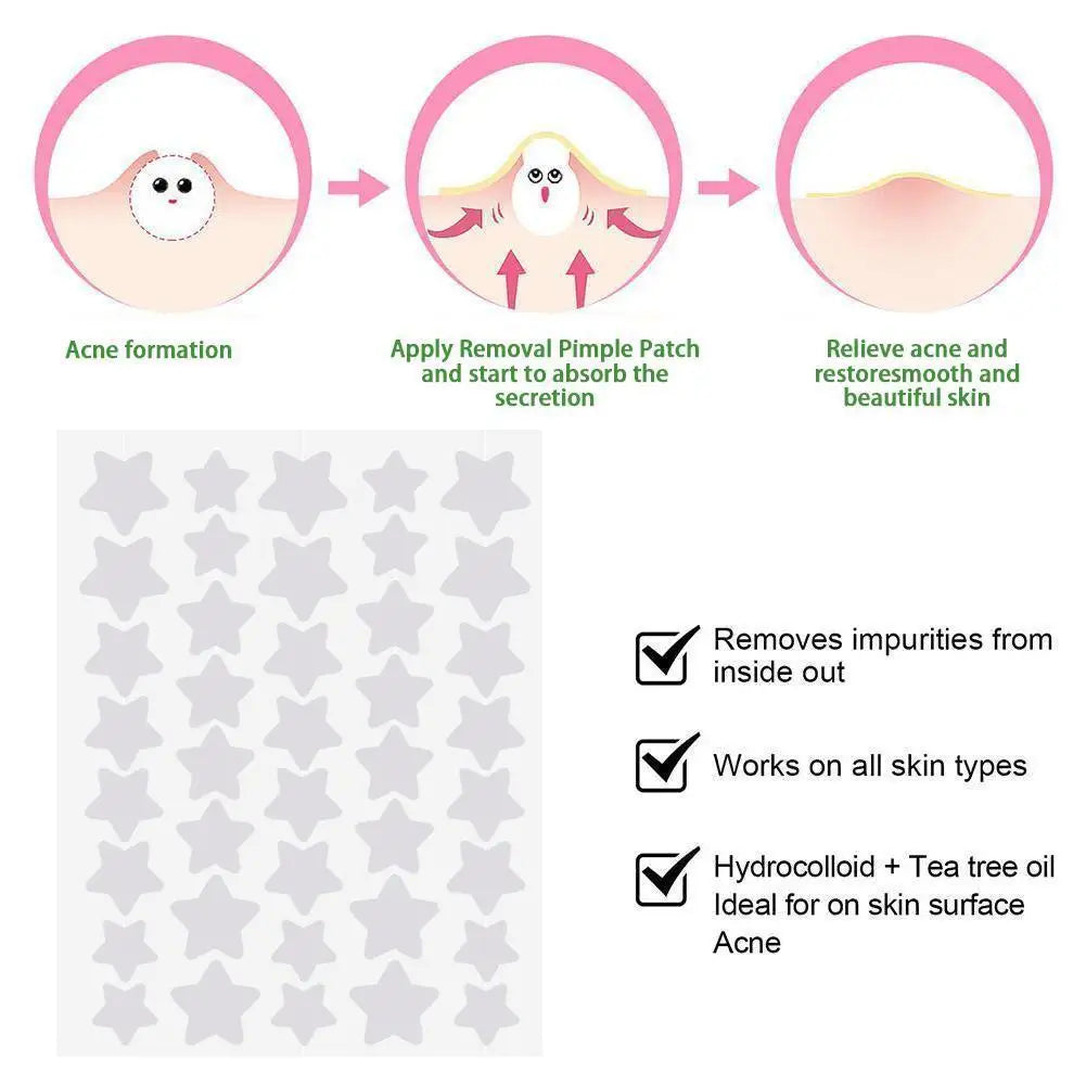 NEW Colorful Star Shaped PE Pimple Patches Acne Invisible Removal Skin Care Stickers Concealer Face Spot Beauty Makeup Tools