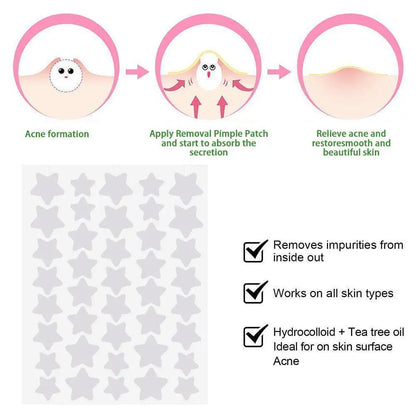 NEW Colorful Star Shaped PE Pimple Patches Acne Invisible Removal Skin Care Stickers Concealer Face Spot Beauty Makeup Tools