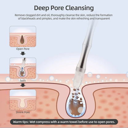 Professional Diamond Microdermabrasion Machine Water Spray Exfoliation Face Peeling Beauty Machine Pore Deep Cleaning Skin Care