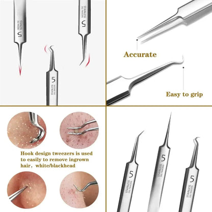 Professional Ultra-fine No. 5 Acne Blackhead Removal Tweezers Beauty Salon Pimples Needles Deep Cleaner Clip Face Skin Care Tool