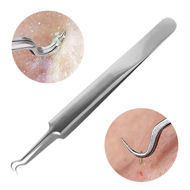 Stainless Steel Acne Removal Needles Pimple Blackhead Remover Tools Spoons Face Skin Care Tools Needles Facial Pore Cleaner