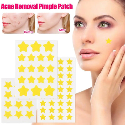 Star Pimple Patch Acne Yellow Invisible Acne Removal Skin Care Stickers Y2K Originality Concealer Face Spot Beauty Makeup Tool