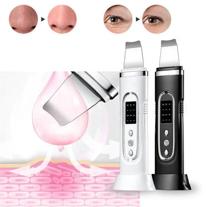 PC Ultrasonic Skin Cleaner Facial Scrubber Exfoliator Skincare Microcurrent Blackhead Remover EMS Vibrator Face Pore Cleansing Tool