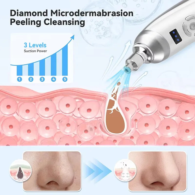 PC Upgraded Diamond Microdermabrasion Machine Blackhead Removal Professiona